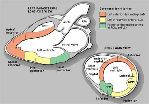 basal inferior wall hypokinesis.